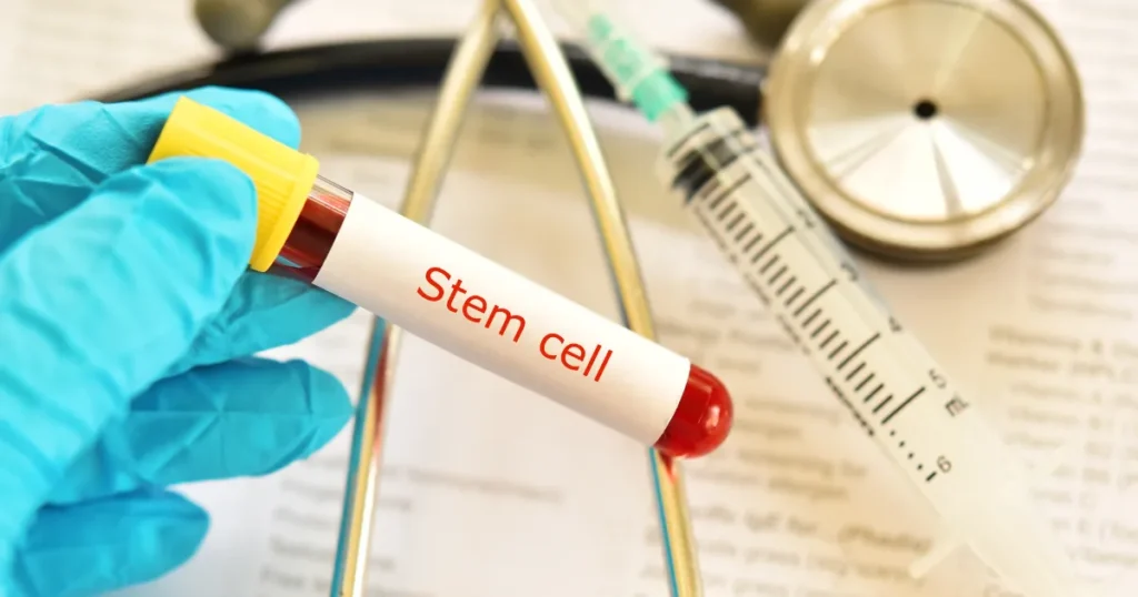 stem cells