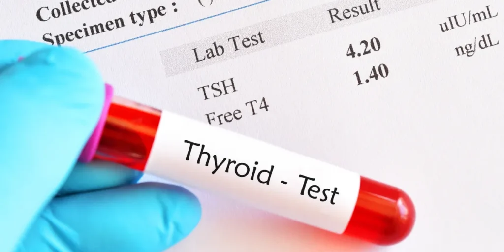 blood test for thyroid therapy