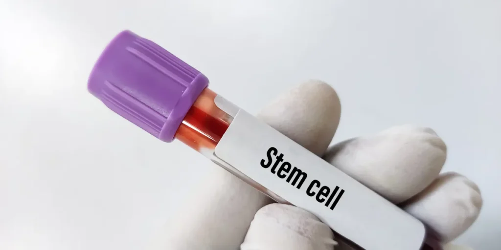 stem cell sample
