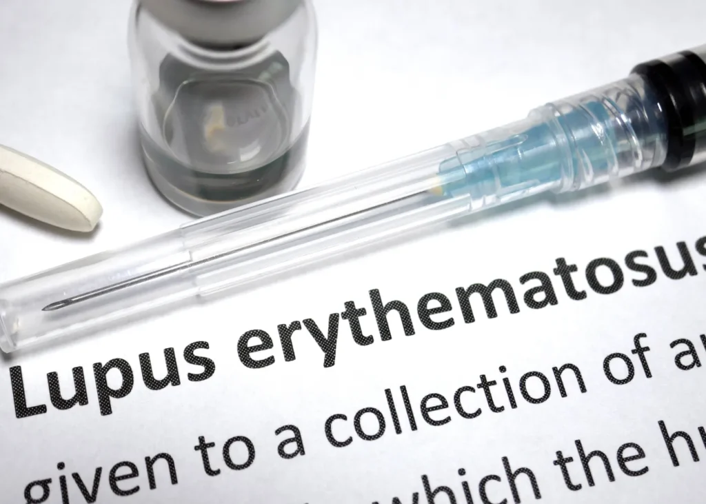lupus