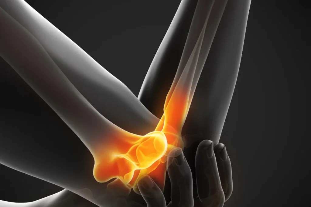 stem cells elbow pain (4)