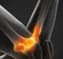 stem cells elbow pain (4)