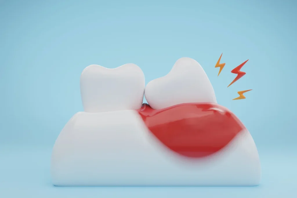 stem-cells-for-teeth
