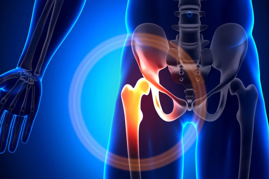 non surgical hip treatment