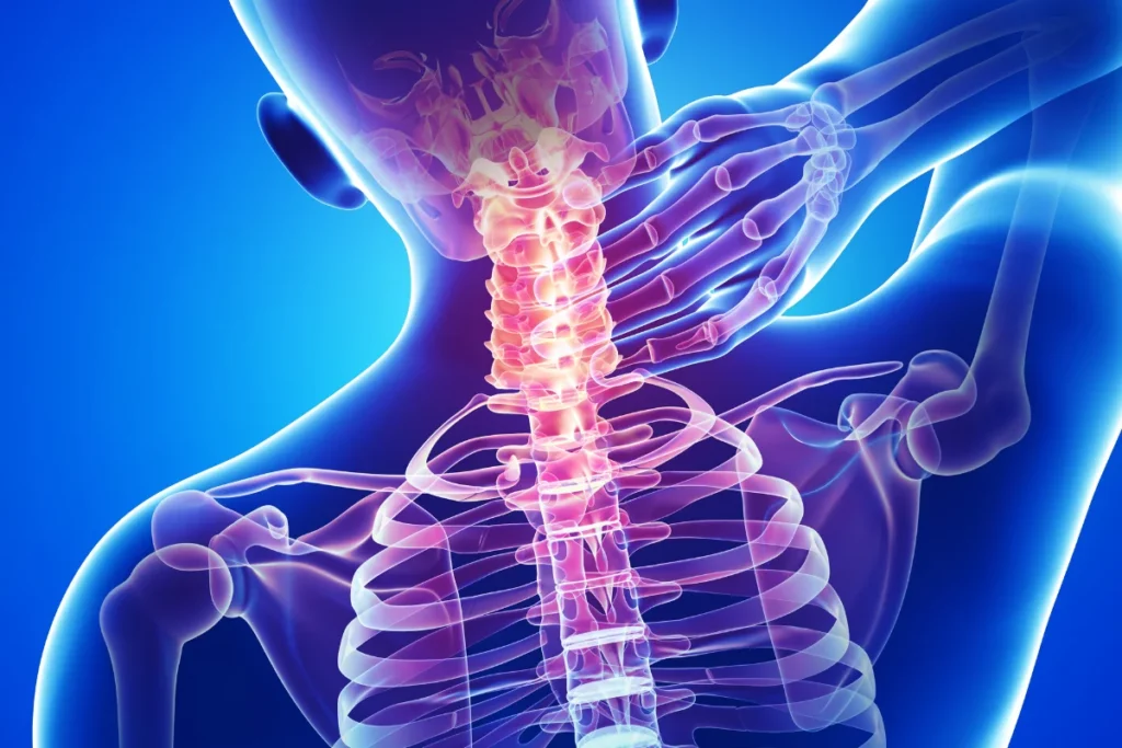 non surgical neck pain treatment