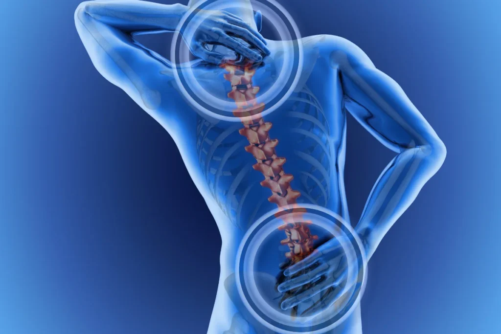 regenerative injection therapy for back pain