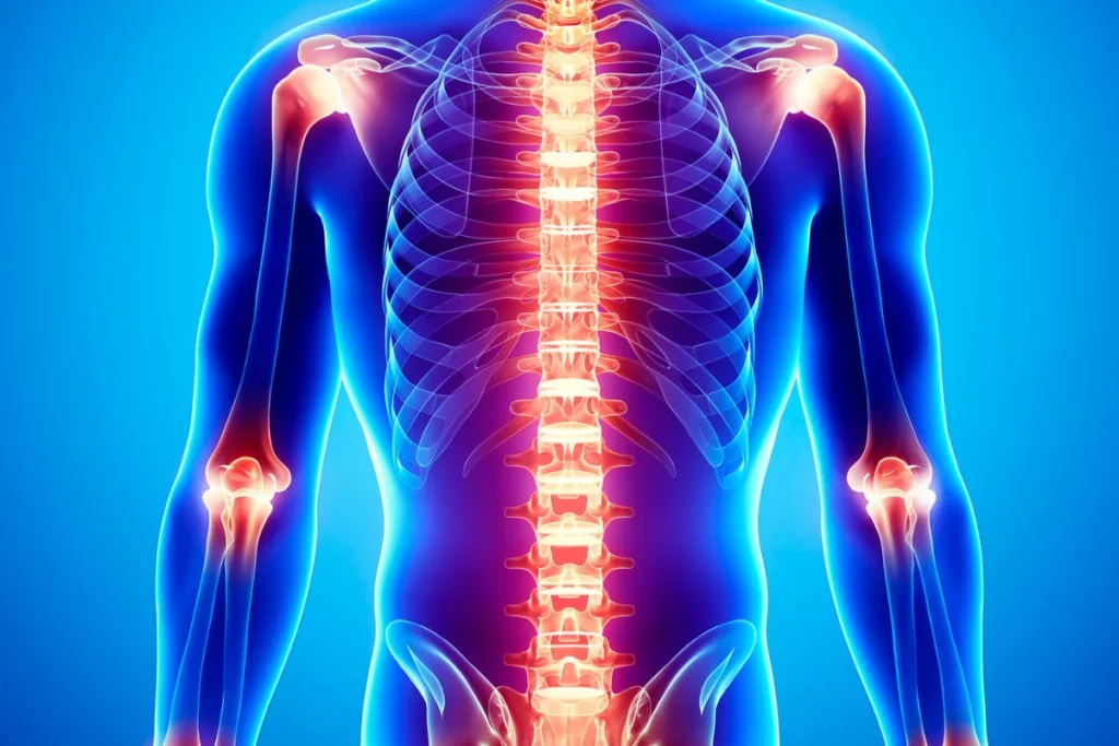 what is chronic pain syndrome
