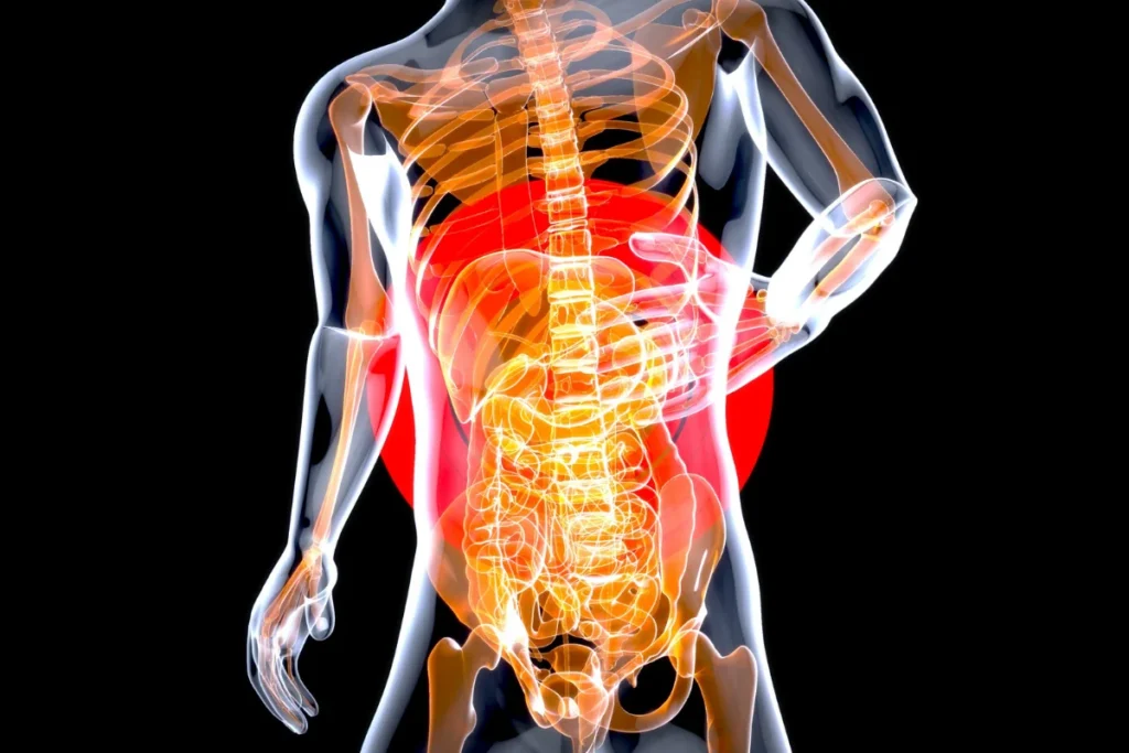 what is chronic pain syndrome