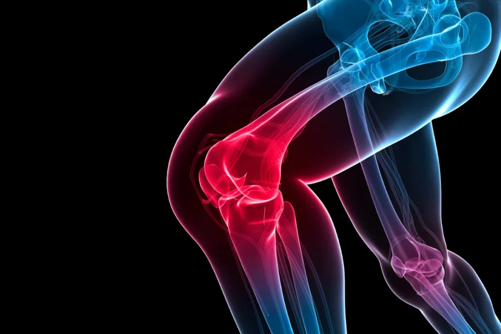 Musculoskeletal injuries