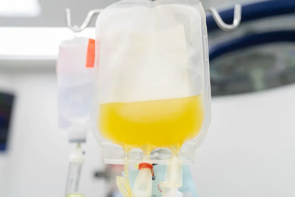 plasmapheresis for multiple sclerosis
