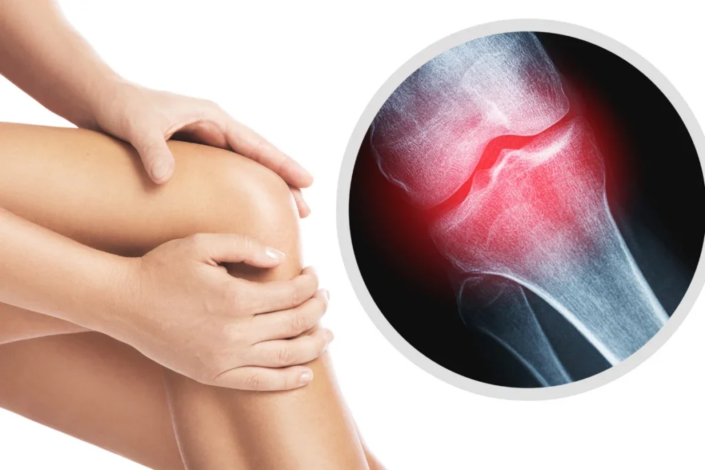 pain from groin to knee female1