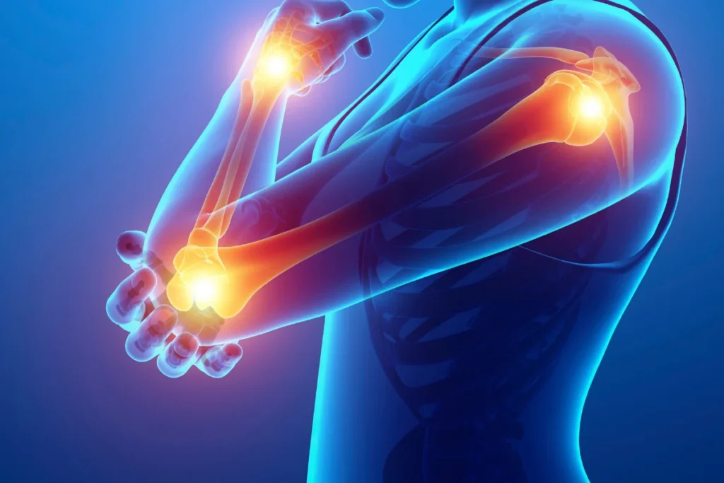 throbbing pain in left arm woman (2)
