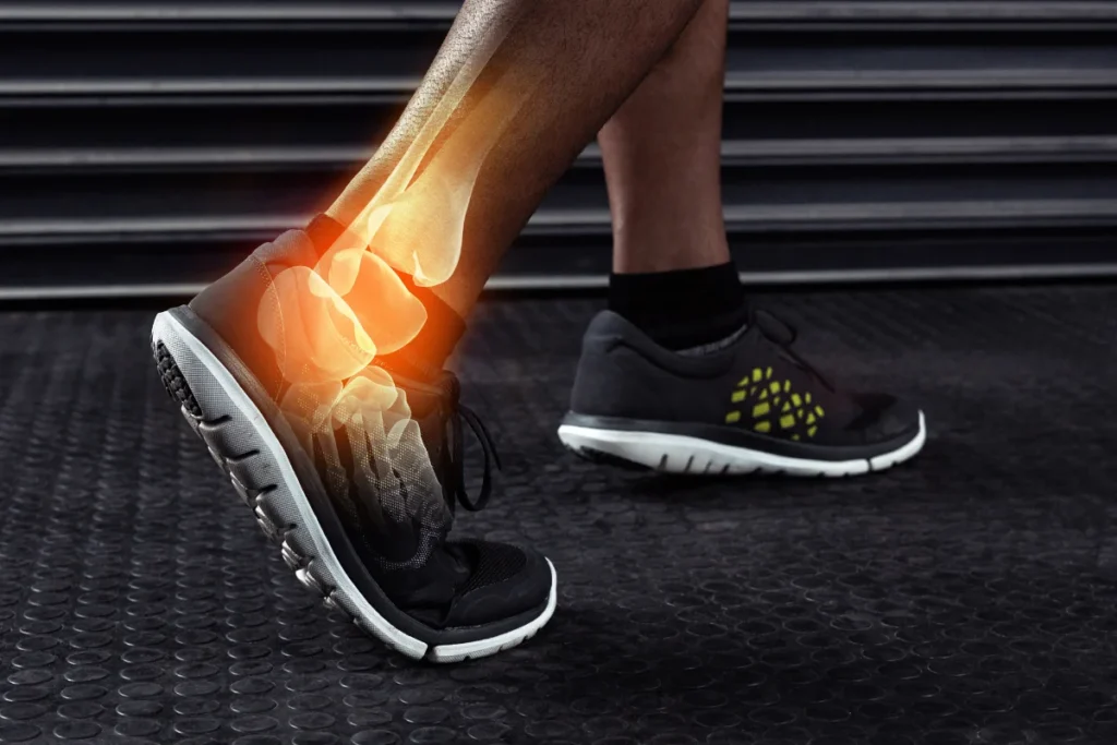 chronic ankle instability (2)