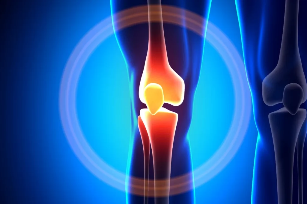 osteochondral-defects