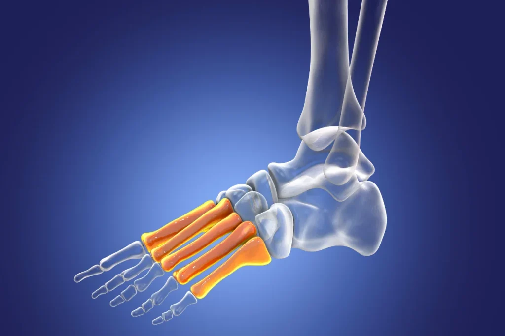 tarsal tunnel syndrome symptoms